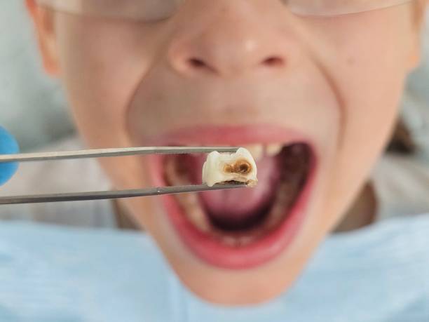 Best Pediatric Emergency Dentist in Rose Lodge, OR